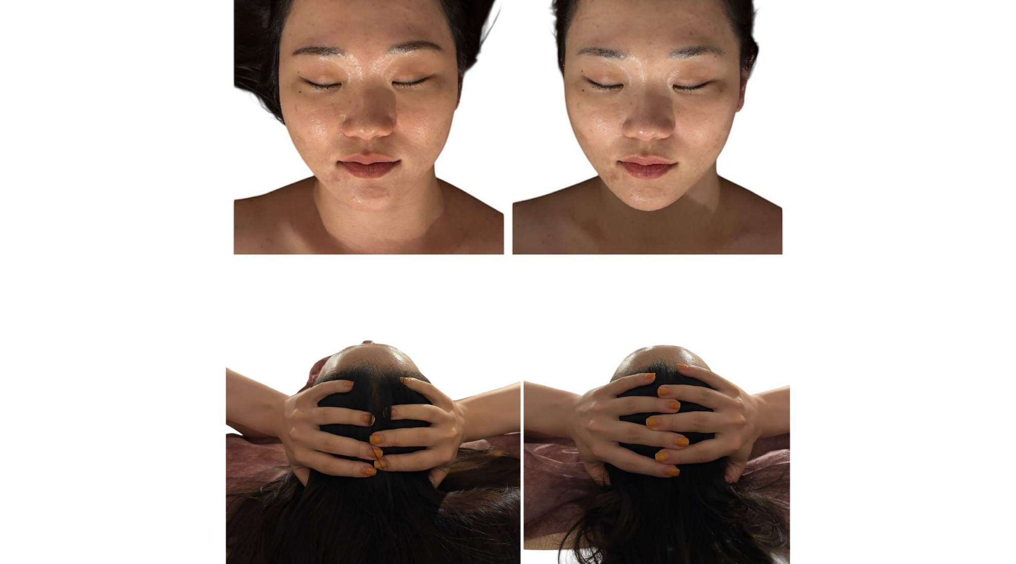 吉川市 NR機器導入 立体小顔矯正